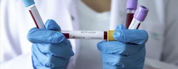 В Украине прогнозируют новую волну коронавируса